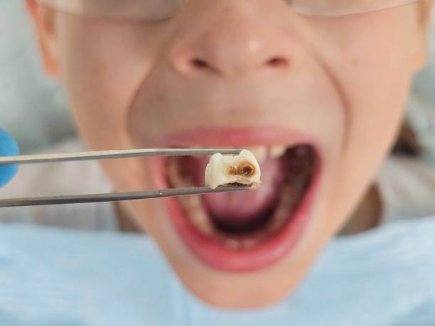 Best Walk-In Emergency Dentist in Mayfair, CA