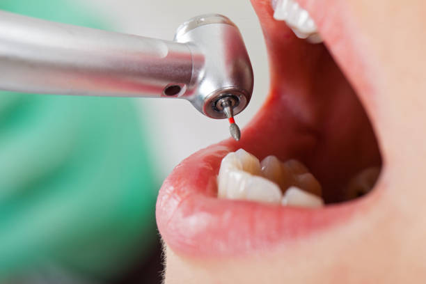 Mayfair, CA Emergency Dentist Pros